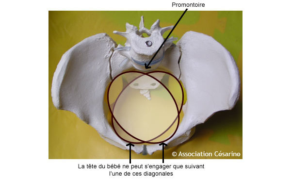 Bassin et Pelvimtrie - Figure 4 © Association Csarine